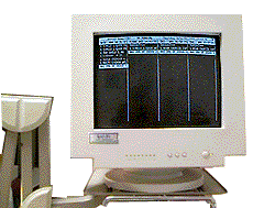 RestEZ Bump Screen Terminal